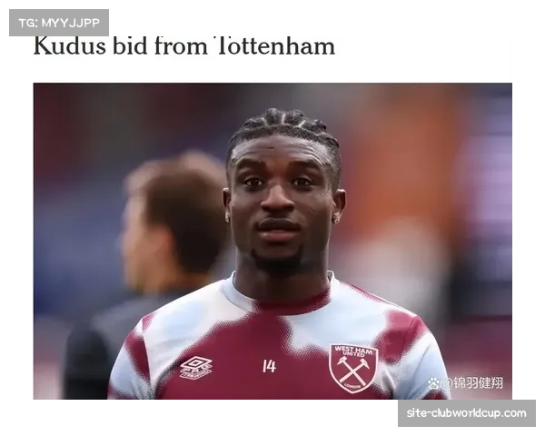 拜仁控球体系面临挑战 穆西亚拉伤缺影响推进效率